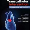 Aortic Valve Transcatheter Intervention: Complications and Solutions 1st Edition