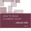 How to Read a Normal Scan: BRAIN MRI PART 2 (High Quality Image PDF)