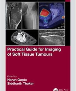 Practical Guide for Imaging of Soft Tissue Tumours (PDF Book)