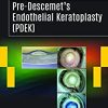 Pre-Descemet’s Endothelial Keratoplasty (PDEK) (PDF Book+Videos)