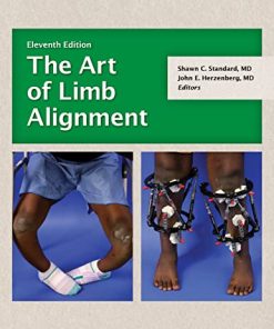 The Art of Limb Alignment, 11th edition (PDF Book)