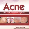 Acne Atlas with Treatment Options (PDF Book)