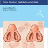 Rinoplastia: Ponta Nasal em Realidade Aumentada (PDF Book)