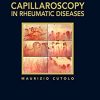 Atlas of capillaroscopy in rheumatic diseases (PDF Book)