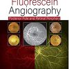 Practical Handbook of Fluorescein Angiography: Posterior Pole and Retinal Periphery, 2nd Edition (PDF Book)