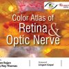 Color Atlas of Retina and Optic Nerve (PDF Book)