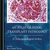 An Atlas of Renal Transplant Pathology (PDF Book)
