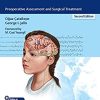 Pediatric Epilepsy Surgery: Preoperative Assessment and Surgical Treatment, 2nd Edition (EPUB)