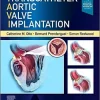Transcatheter Aortic Valve Implantation (PDF Book)