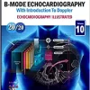 Echocardiography Illustrated: Ultrasound Physics: B-Mode Echocardiography and Introduction to Doppler (Echocardiograhy Illustrated) (PDF)