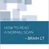 How to Read a Normal Scan : Brain CT (High Quality Image PDF)