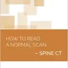How to Read a Normal Scan : SPINE CT (High Quality Image PDF)