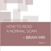 How to Read a Normal Scan: BRAIN MRI PART 1 (High Quality Image PDF)