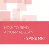 How to read a Normal Scan: Spine MRI (High Quality Image PDF)
