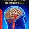 Aneurysmal Subarachnoid Hemorrhage: From Diagnosis to Treatment (PDF Book)