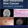 Non-melanoma Skin Cancer: Essentials for Oncologists (PDF)