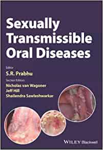 Sexually Transmissible Oral Diseases (PDF Book)