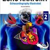 Echo Anatomy, 2nd edition (Echocardiography Illustrated) (Volume 2) (PDF)
