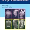 Corrective Osteotomies for Rigid Spinal Deformities (PDF)