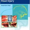 Surgical Nuances of Head Injury (PDF Book)