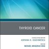Thyroid Cancer, An Issue of Endocrinology and Metabolism Clinics of North America (Volume 48-1) (The Clinics: Internal Medicine, Volume 48-1) (PDF)