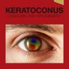 Keratoconus: Diagnosis and Management (PDF Book)