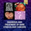 Diagnosis and Treatment of Rare Gynecologic Cancers (PDF Book)