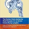 The Human Brain during the First Trimester 31- to 33-mm Crown-Rump Lengths: Atlas of Human Central Nervous System Development, Volume 5 (PDF Book)