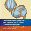 The Human Brain during the First Trimester 21- to 23-mm Crown-Rump Lengths: Atlas of Human Central Nervous System Development, Volume 4 (PDF)