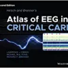 Hirsch and Brenner’s Atlas of EEG in Critical Care, 2nd Edition (PDF Book)