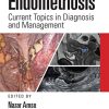 Endometriosis: Current Topics in Diagnosis and Management (EPUB)