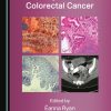 Hereditary and Familial Colorectal Cancer (PDF)