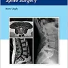 Instrumentation for Minimally Invasive Spine Surgery (EPUB)