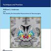 Deep Brain Stimulation: Techniques and Practices (EPUB)