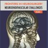 NeuroEndovascular Challenges: Frontiers in Neurosurgery Volume 1 (PDF Book)