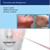 Complications in Minimally Invasive Facial Rejuvenation: Prevention and Management (EPUB)