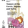 Tumors of the Cervix, Vagina, and Vulva (AFIP Atlas of Tumor Pathology, Series 5) (PDF)