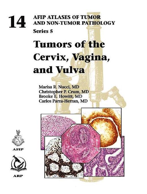 Tumors of the Cervix, Vagina, and Vulva (AFIP Atlas of Tumor Pathology, Series 5) (PDF)