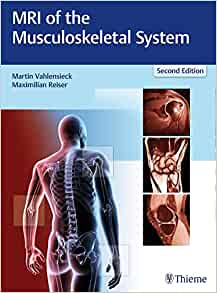 MRI of the Musculoskeletal System, 2nd Edition (EPUB)