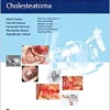 Microsurgical Management of Middle Ear and Petrous Bone Cholesteatoma (EPUB)