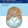Meningiomas of the Skull Base: Treatment Nuances in Contemporary Neurosurgery (EPUB)