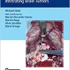 Video Atlas of Neurophysiological Monitoring in Surgery of Infiltrating Brain Tumors (EPUB)