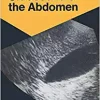 Ultrasound of the Abdomen: 114 Radiological Exercises for Students and Practitioners (Exercises in Radiological Diagnosis) (EPUB)