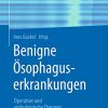 Benigne Ösophaguserkrankungen: Operative und endoskopische Therapie (German Edition) (PDF Book)