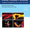 ECO-DOPPLER das Artérias Carótidas e Vertebrais: Avaliação Diagnóstica dos Vasos Cervicais (PDF)