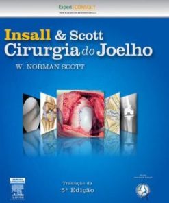 Insall & Scott Cirurgia do Joelho