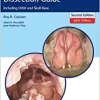 Endoscopic Sinonasal Dissection Guide: Including Orbit and Skull Base, 2nd Edition (Videos Only)