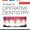Textbook of Operative Dentistry (PDF Book)