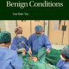 Hysterectomy for Benign Conditions (PDF Book)