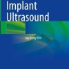 Atlas of Breast Implant Ultrasound (PDF Book)